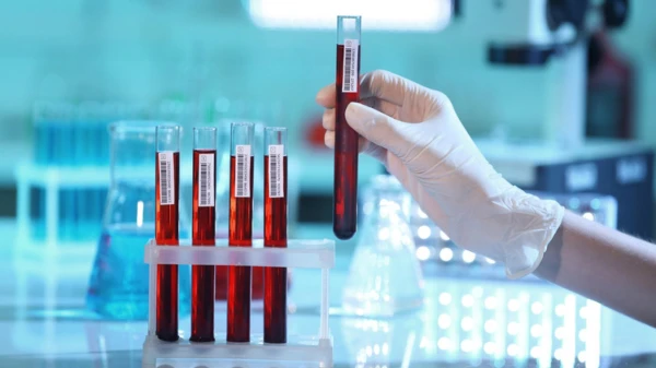 Stroke Before Age 60 Found to Be Linked to Blood Characteristics