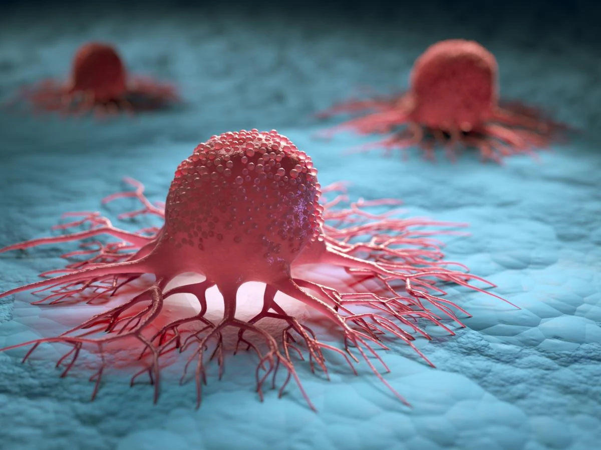 Breakthrough in Pancreatic Cancer Treatment: New Drug Reduces Death Risk by 60%