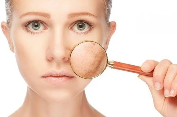 Your Skin «Remembers» Everything: 6 Habits That Cause Pigmentation Spots