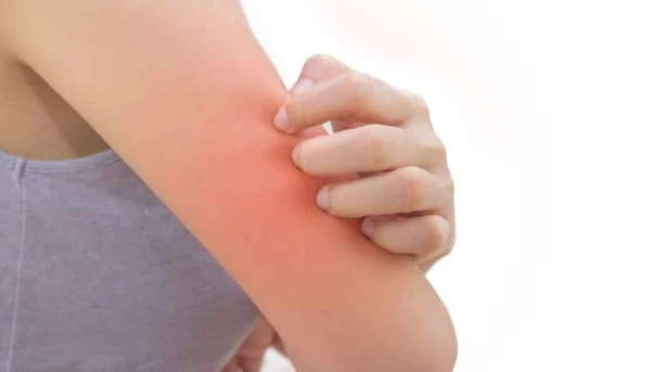 Why Skin Starts to Itch in Winter: Scientists Found an Unexpected Cause