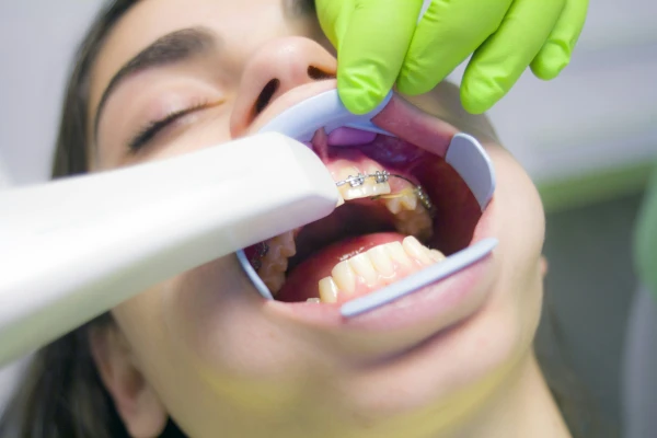 You Have to Book an Appointment with the Dentist Six Months in Advance