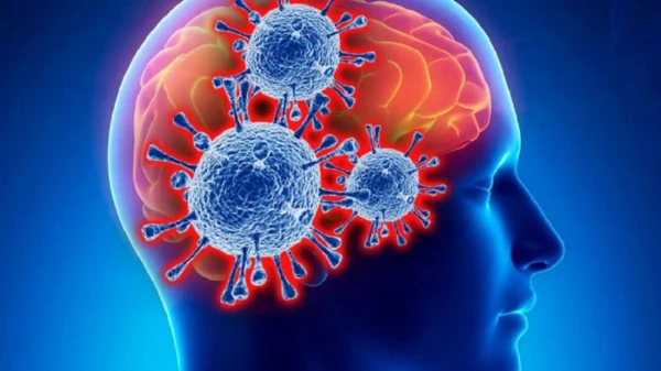 COVID-19 and the Brain: How the Virus Can Accelerate Aging by 20 Years
