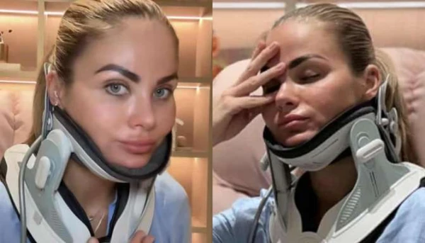 Beauty Queen Diana Kubasova Suffers from Neck Pain and Migraines, Doctor Recommended Botox