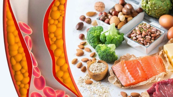 Without Thrombi. Doctor Outlines Ten Dietary Recommendations for Lowering Cholesterol