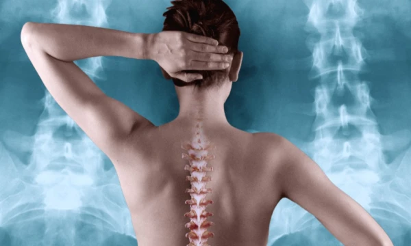 How to Keep Your Spine Healthy: 5 Simple Habits