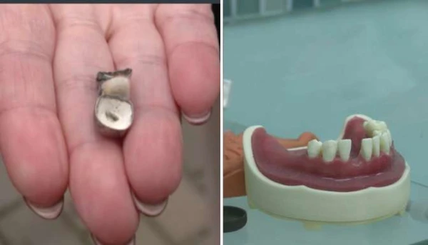 “Pornography” in the Mouth! Patient Shocked by Dentist's Service