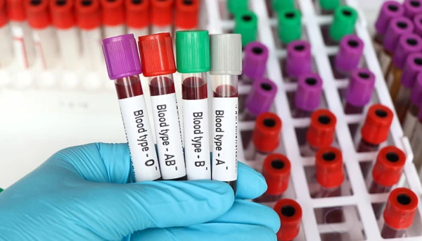 Your Blood Type May Reveal Health Risks — Check Yours