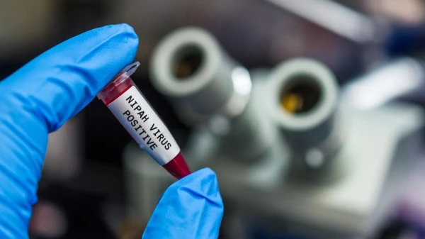 Tests at Airports and Quarantine Measures: Why the Nipah Virus Causes Concern