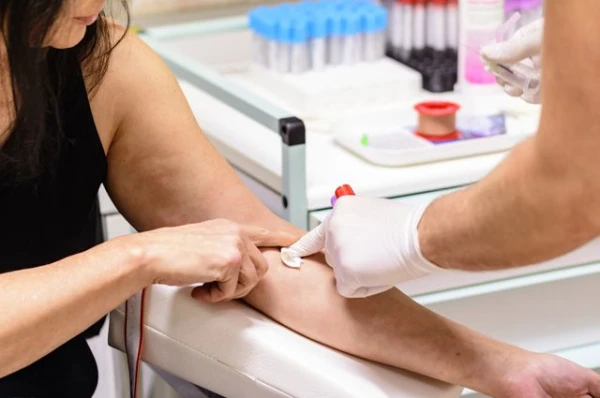 Can you drink tea before giving blood for tests?