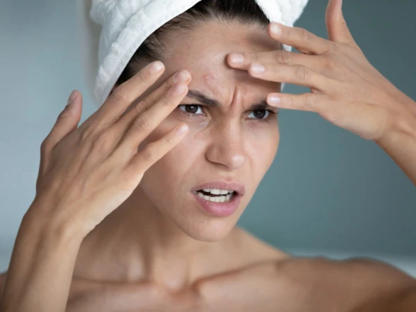 Stress on the Face: How Nerves Reflect on the Skin and What to Do About It