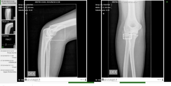 Artificial Intelligence Has 'Reached' Human Vessels
