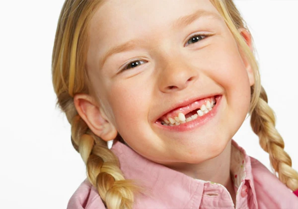 Should Milk Teeth Be Treated or Can We Wait for Them to Fall Out