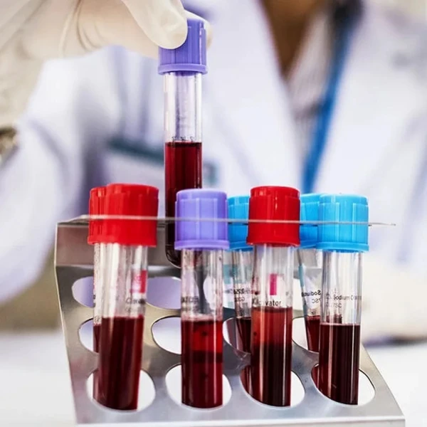 A Simple Blood Test Can Predict Who Will Die Within Two Years