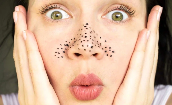 Stop Damaging Your Skin: The Most Dangerous Ways to Fight Blackheads