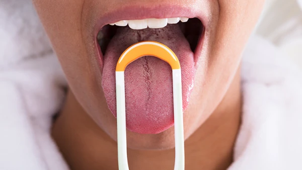 It's Not About Food: Why Tongue Coating Occurs