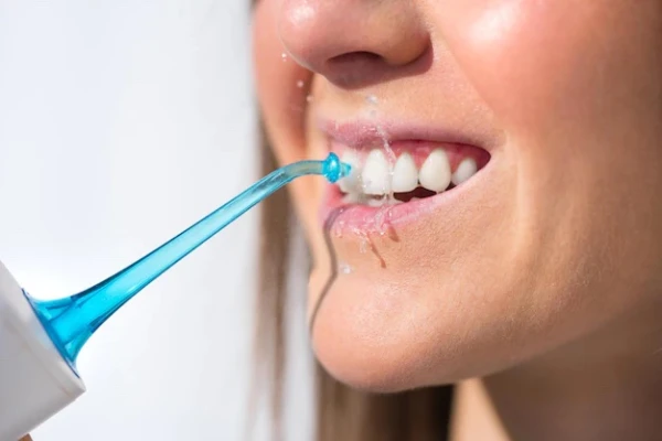Irrigator and Tongue Scraper: A Fashion Trend or a Useful Habit for Oral Hygiene