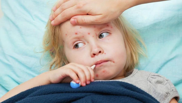 In connection with a laboratory-confirmed case of measles, contacts are urged to respond