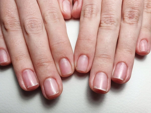 The Truth About Gel Polish: Hidden Harm and Recovery Methods