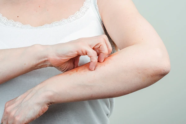 From Allergies to Diabetes: Causes of Itching You Should Know About