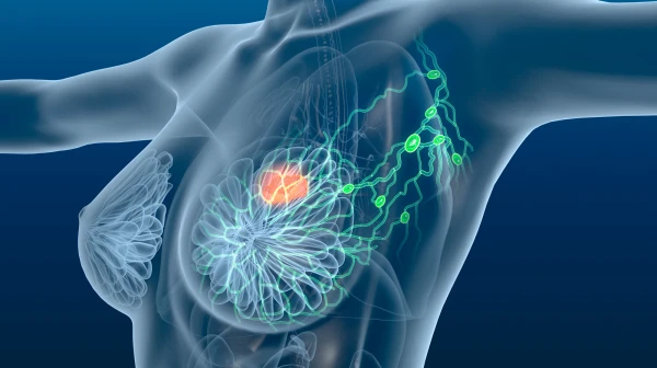 What Influences the Risk of Breast Cancer: New Research Findings