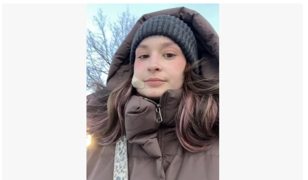 Blogger Lisa Sukhareva Squeezed a Pimple on Her Face and Nearly Lost Her Life