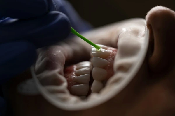 The doctor warned about the hidden danger of unnoticed tooth wear
