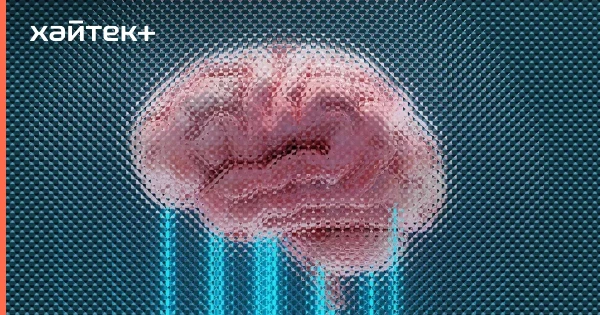 Revolutionary Combination of Drugs Reduces the Risk of Recurrent Stroke by Nearly 40%