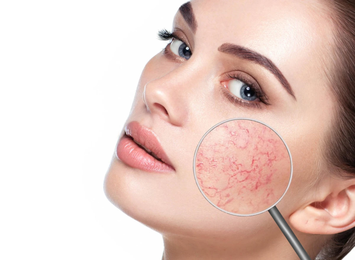 When the Skin 'Speaks': Which Diseases Begin with External Symptoms