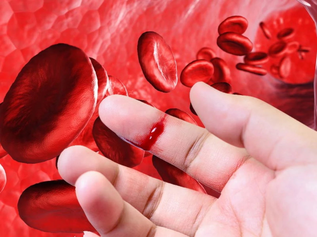 How to Thin Blood Without Medications: Doctor's Advice